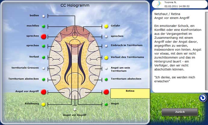 NES_Hirnhologramm_-Netzhaut